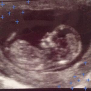 Charlie Michael is our newest little bookworm and will arrive sometime this summer.  